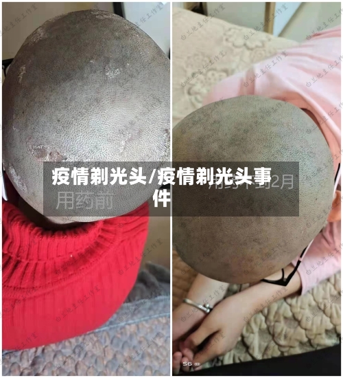 疫情剃光头/疫情剃光头事件-第3张图片