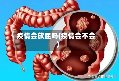 疫情会放屁吗(疫情会不会)-第1张图片