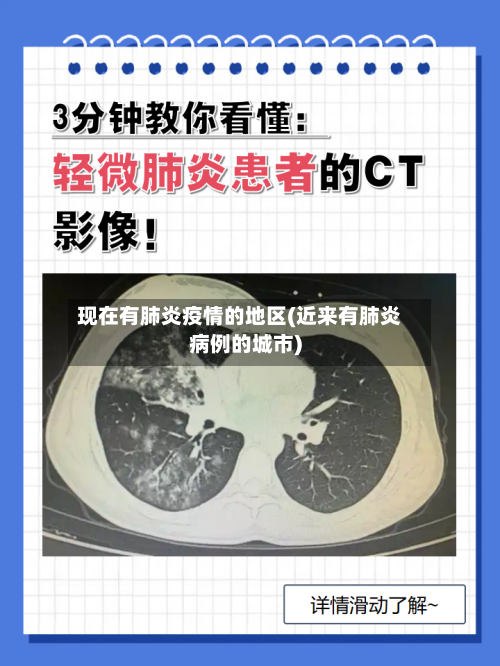 现在有肺炎疫情的地区(近来有肺炎病例的城市)-第1张图片