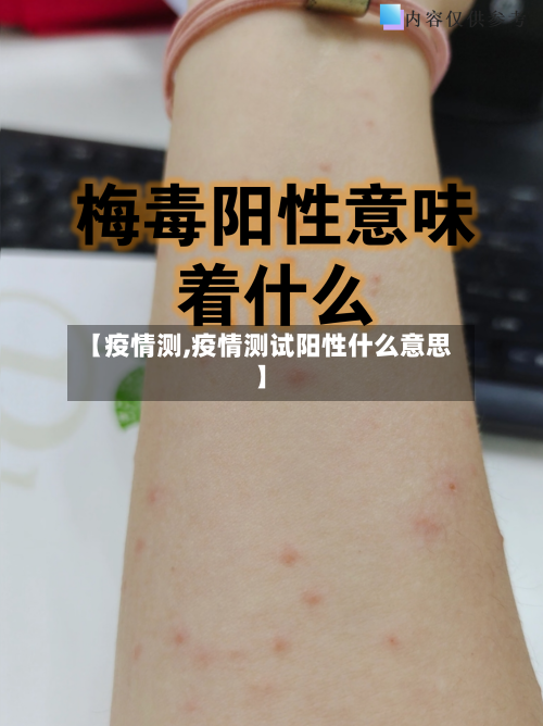 【疫情测,疫情测试阳性什么意思】-第2张图片