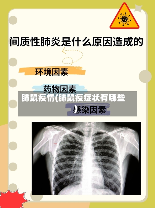 肺鼠疫情(肺鼠疫症状有哪些)-第2张图片